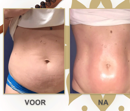 Gua Sha Wooden Therapy Staaf